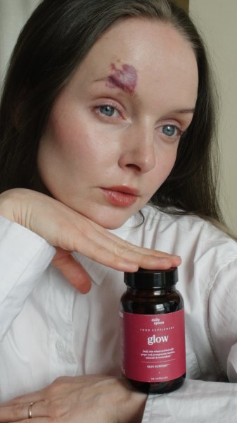 IMG_8685